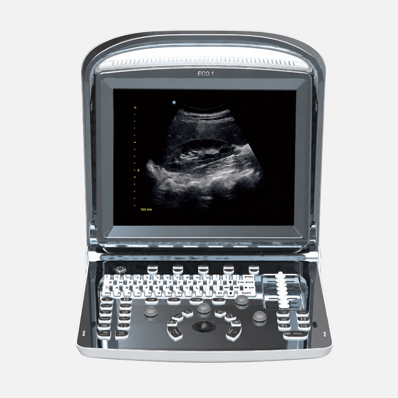 Ecógrafo Chison portátil ECO 1 con sonda lineal L7M-A