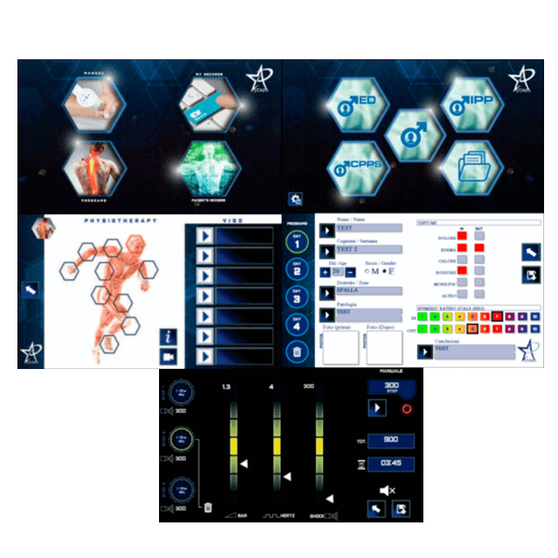 Ondas de choque radial y focal STARWAVE + carro STAR